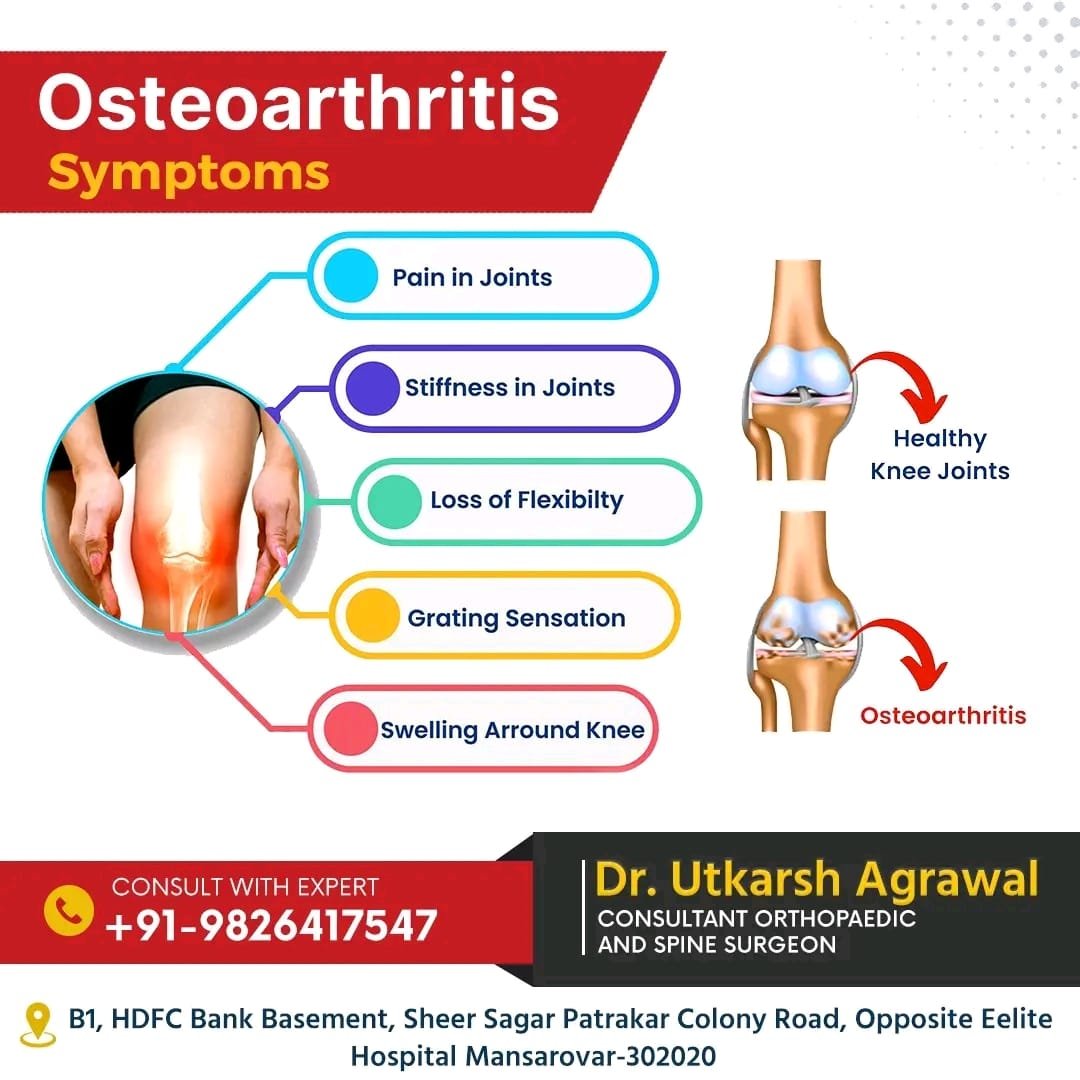 Osteoarthritis Symptoms and Treatment in Mansarovar, Jaipur